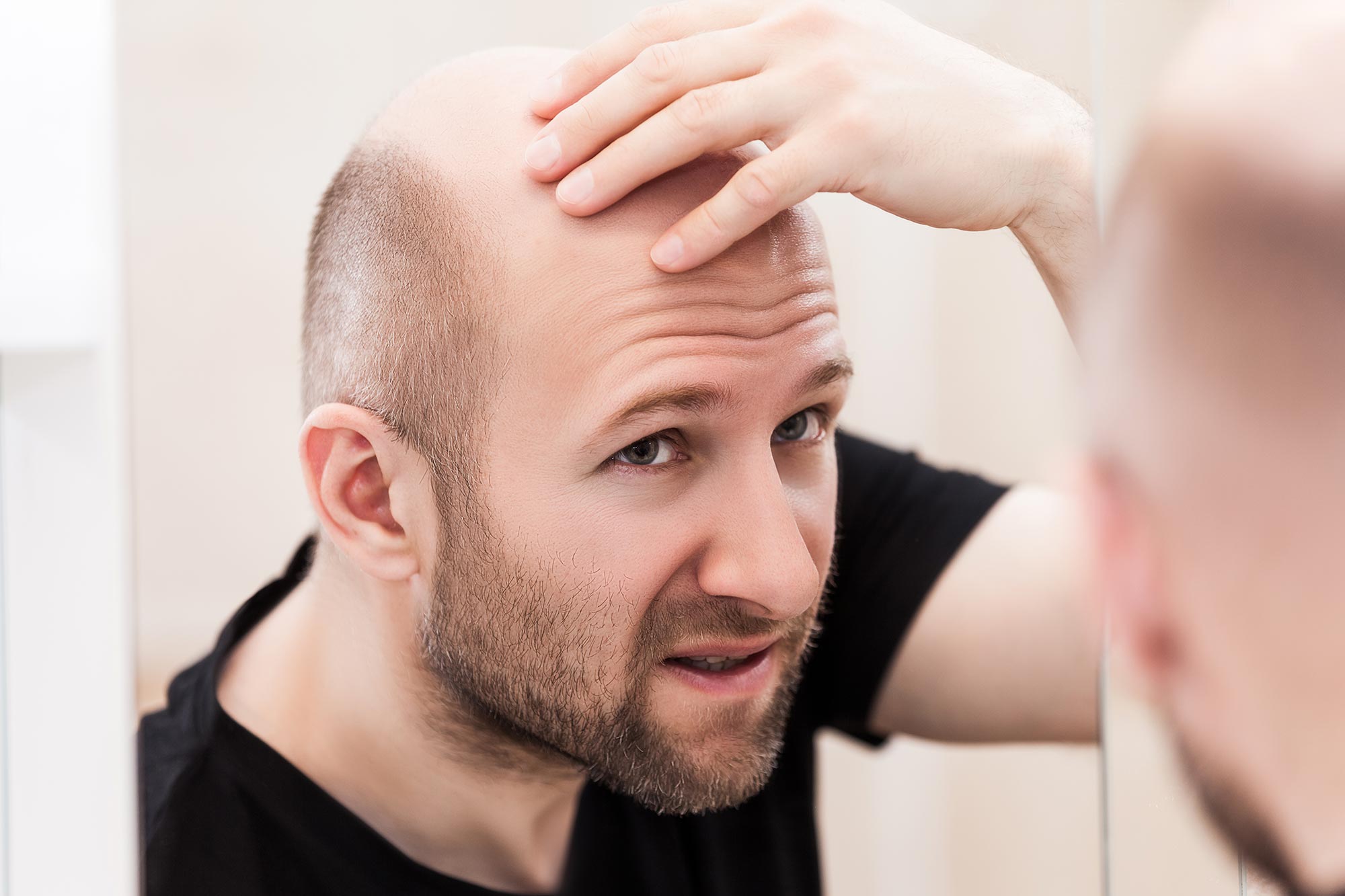 Good news for Bald People