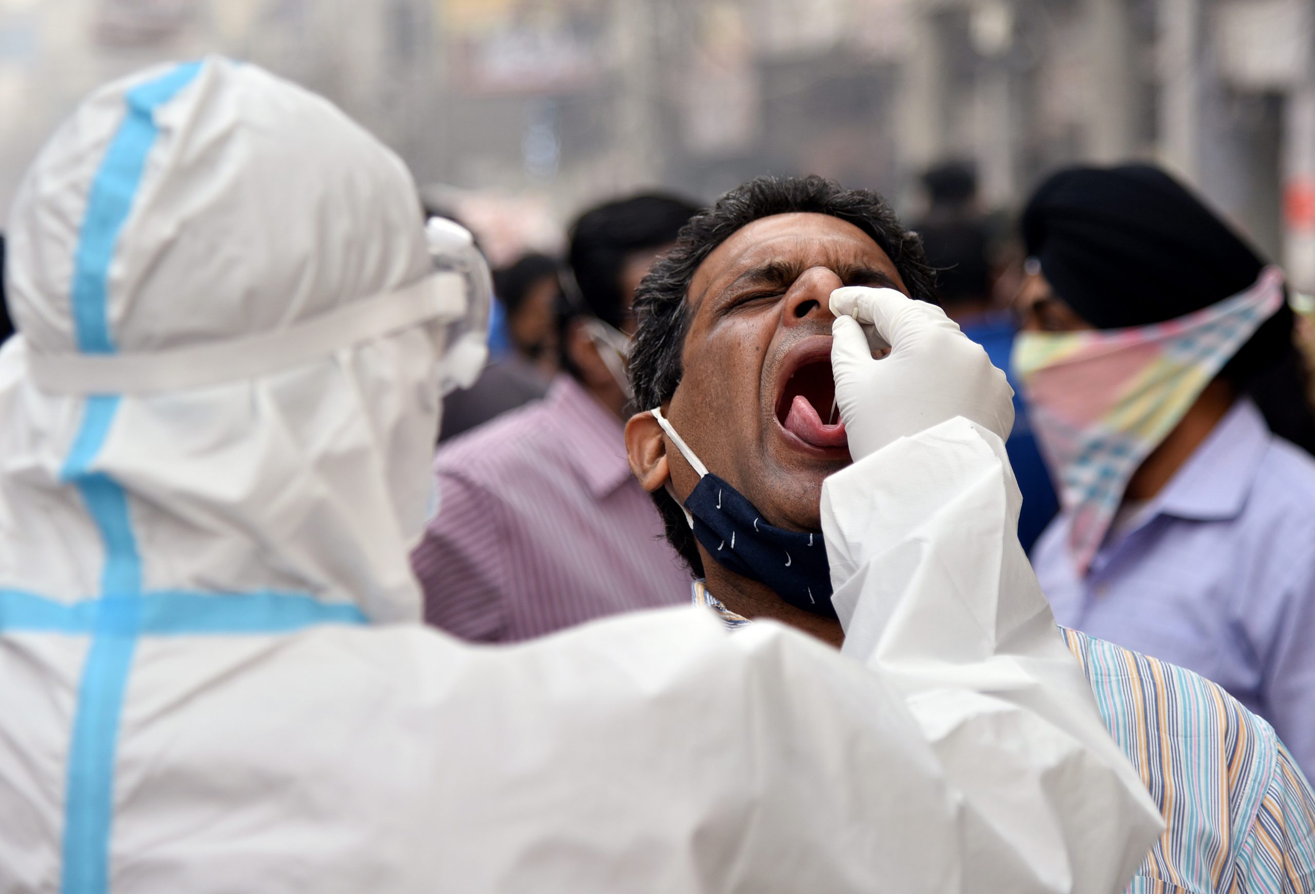 Death toll rises to 3 million in India due to Covid-19