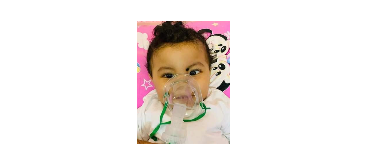 Funds being raised for treatment of nine-month-old Usman