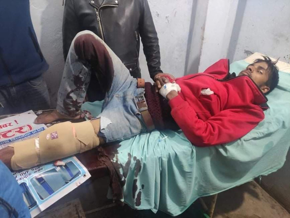 A shot was fired at the Congress polling station, seven injured