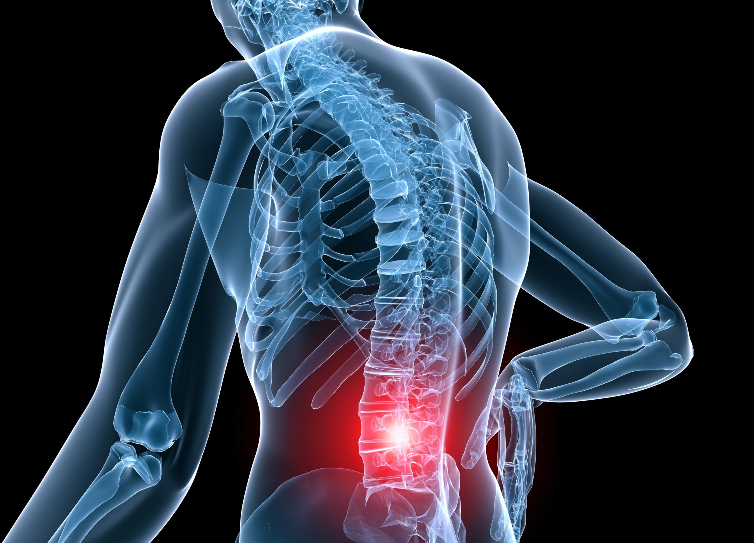 Not all low back pain is the same