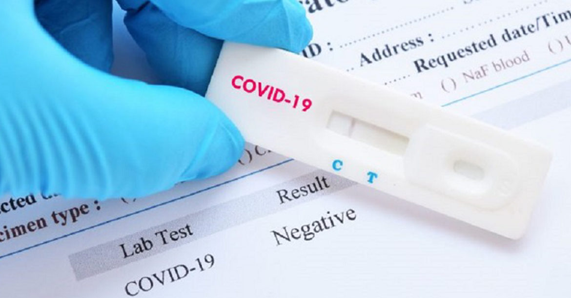 Government withdraws PCR test rule to seek medical care