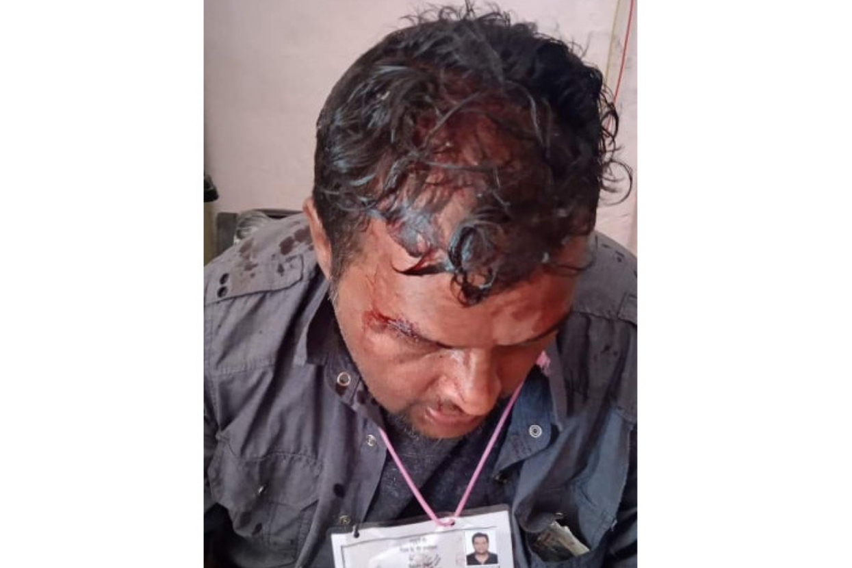 Tension in Tanahun, candidate beaten