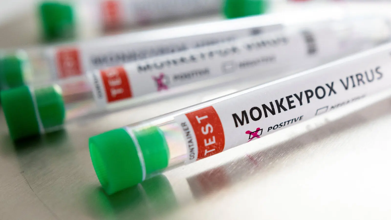 Nigeria confirms 21 monkeypox cases