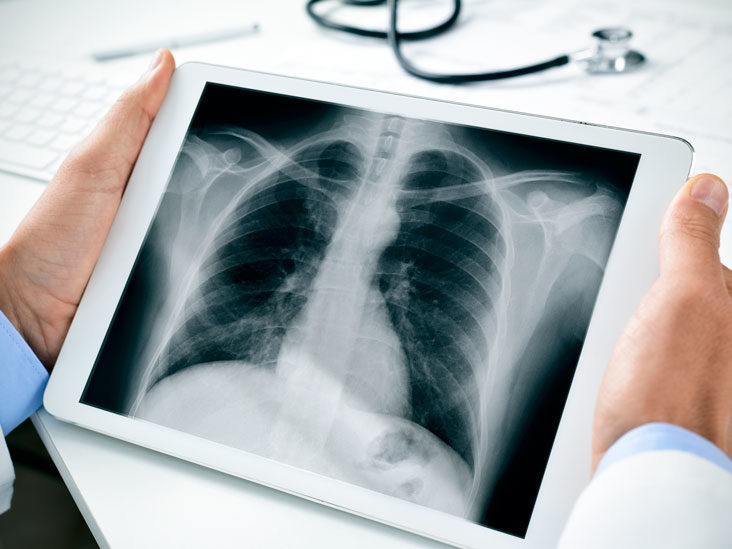 Video X-ray service at village eases pregnant women