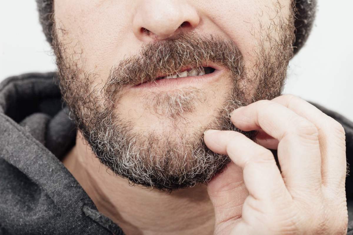 What may be causing your itchy beard?