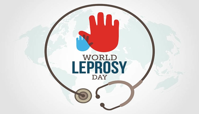 World Leprosy Day being observed today