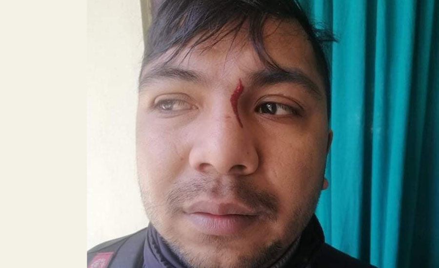 Kaski: Ward Chair Ram Bahadur Gurung assaulted employee