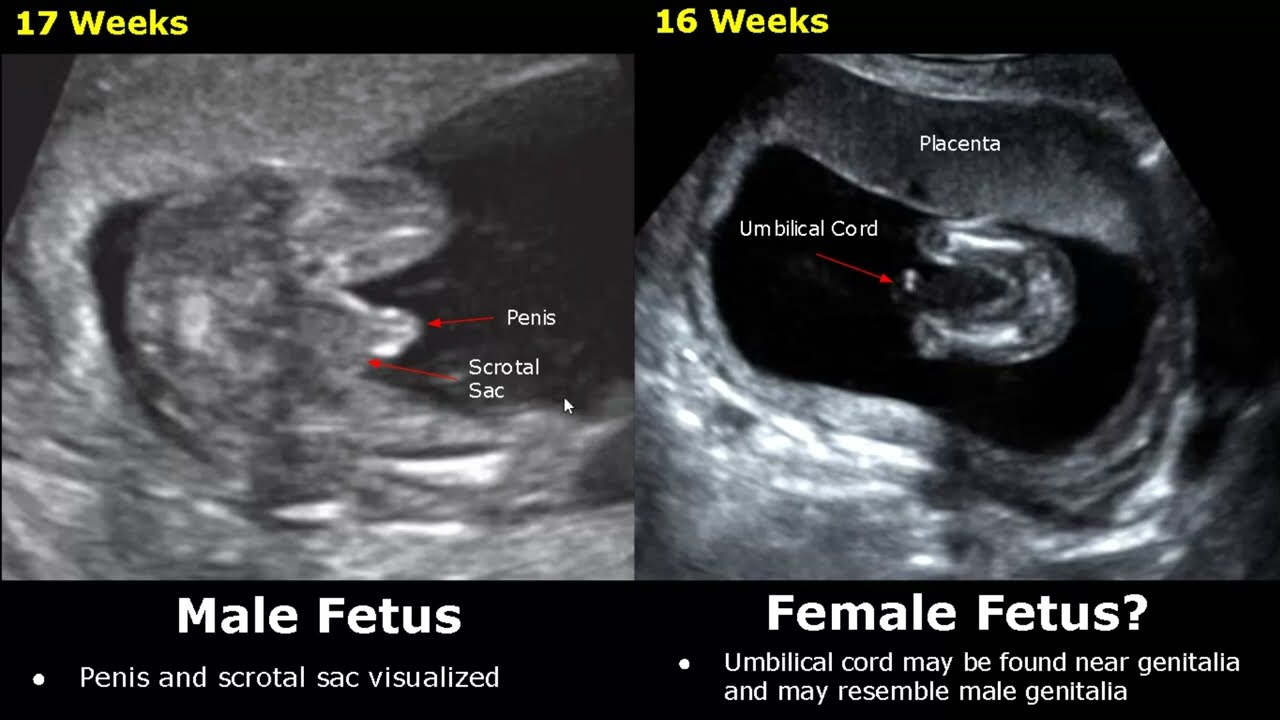 Anyone who identifies as having a son or daughter in the womb to imprisoned for 1 year