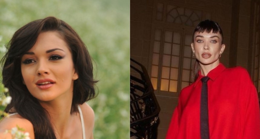 How did Amy Jackson’s face undergo such drastic change?