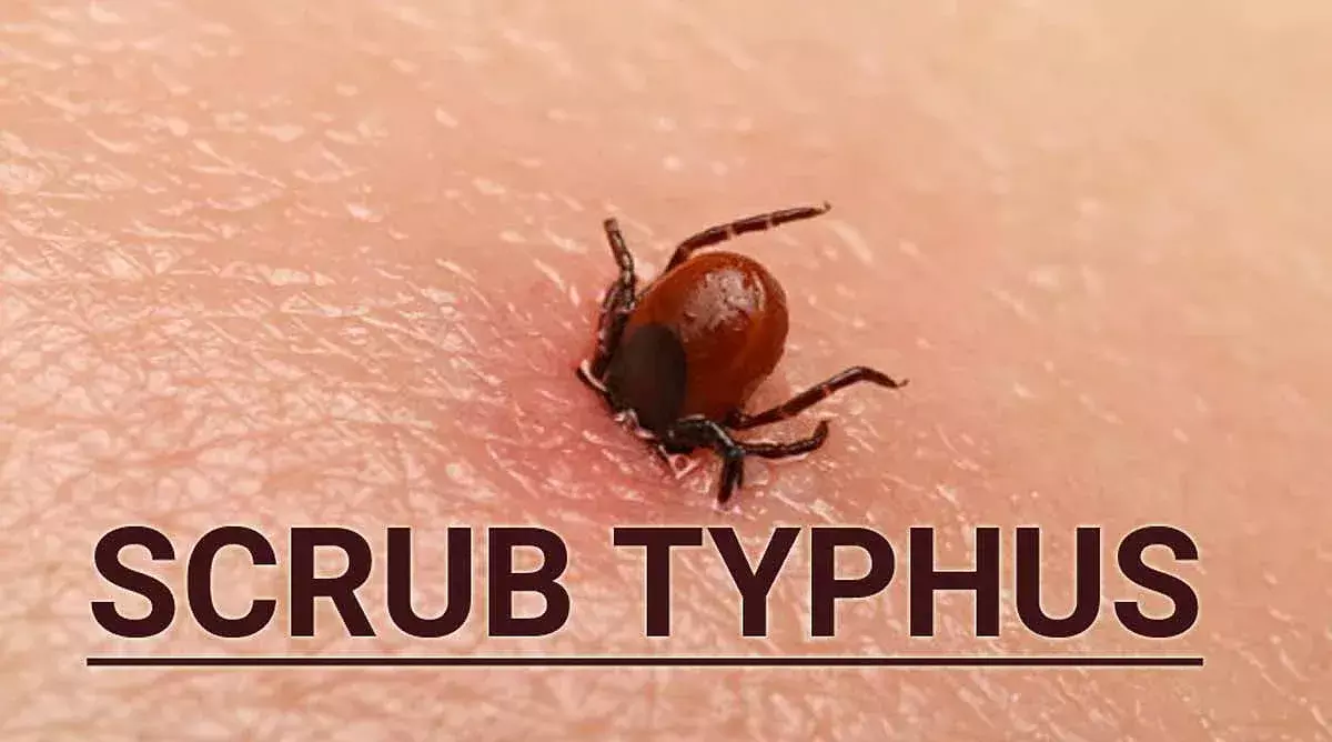 Woman dies of scrub typhus