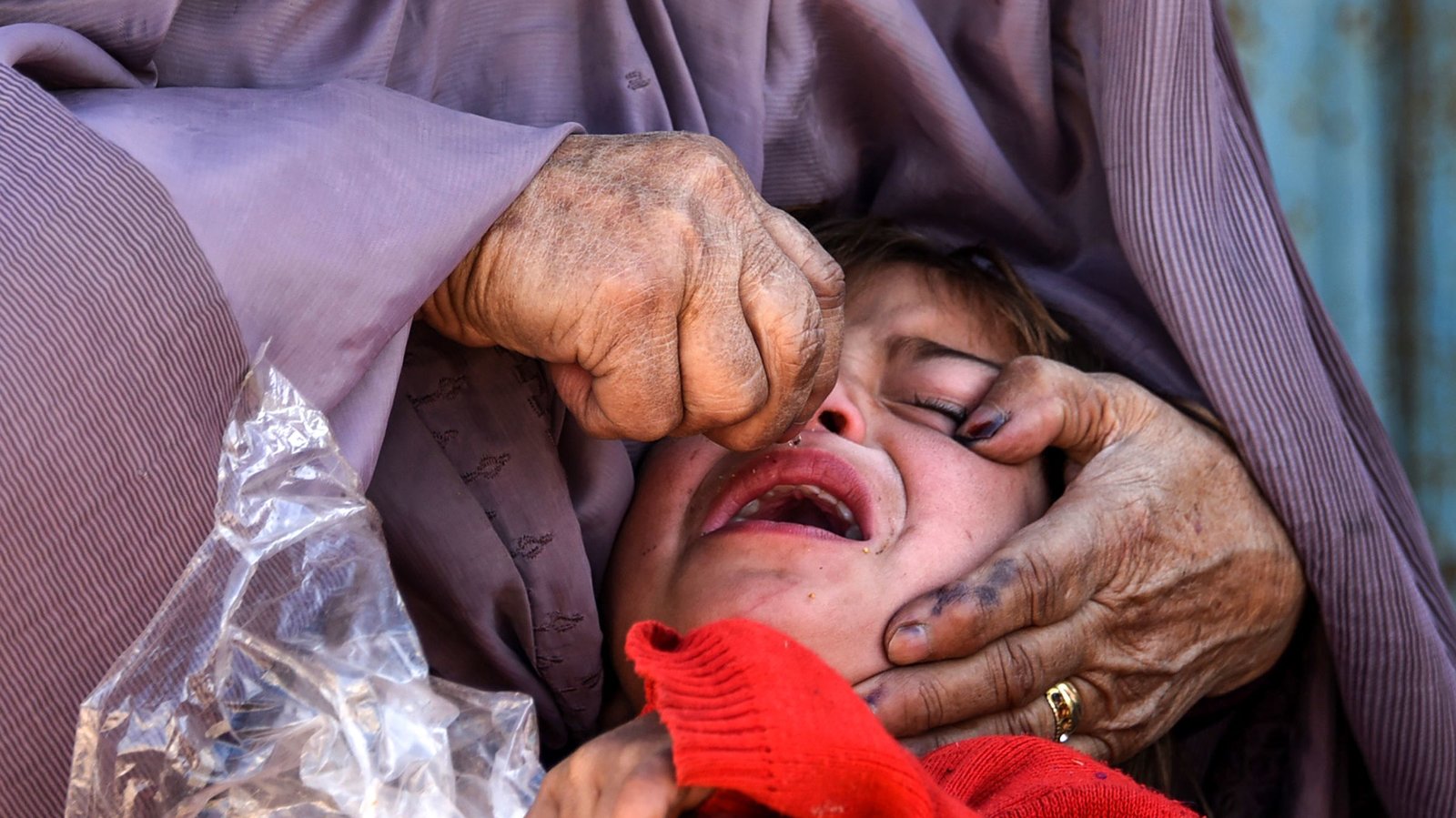 Polio cases rise in Pakistan, Afghanistan