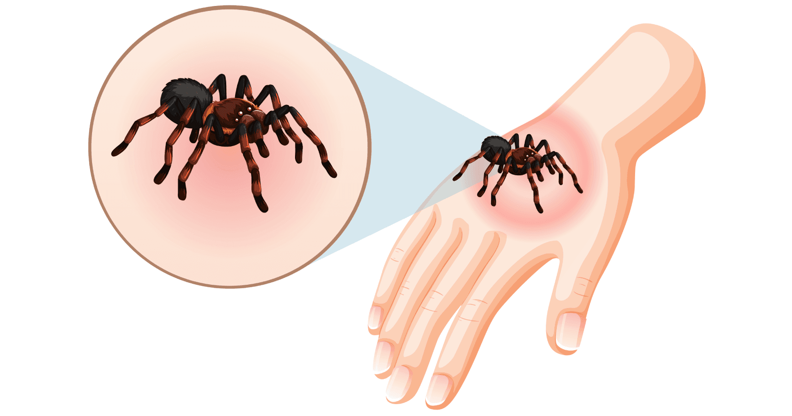 What to do when bitten by a deadly spider?