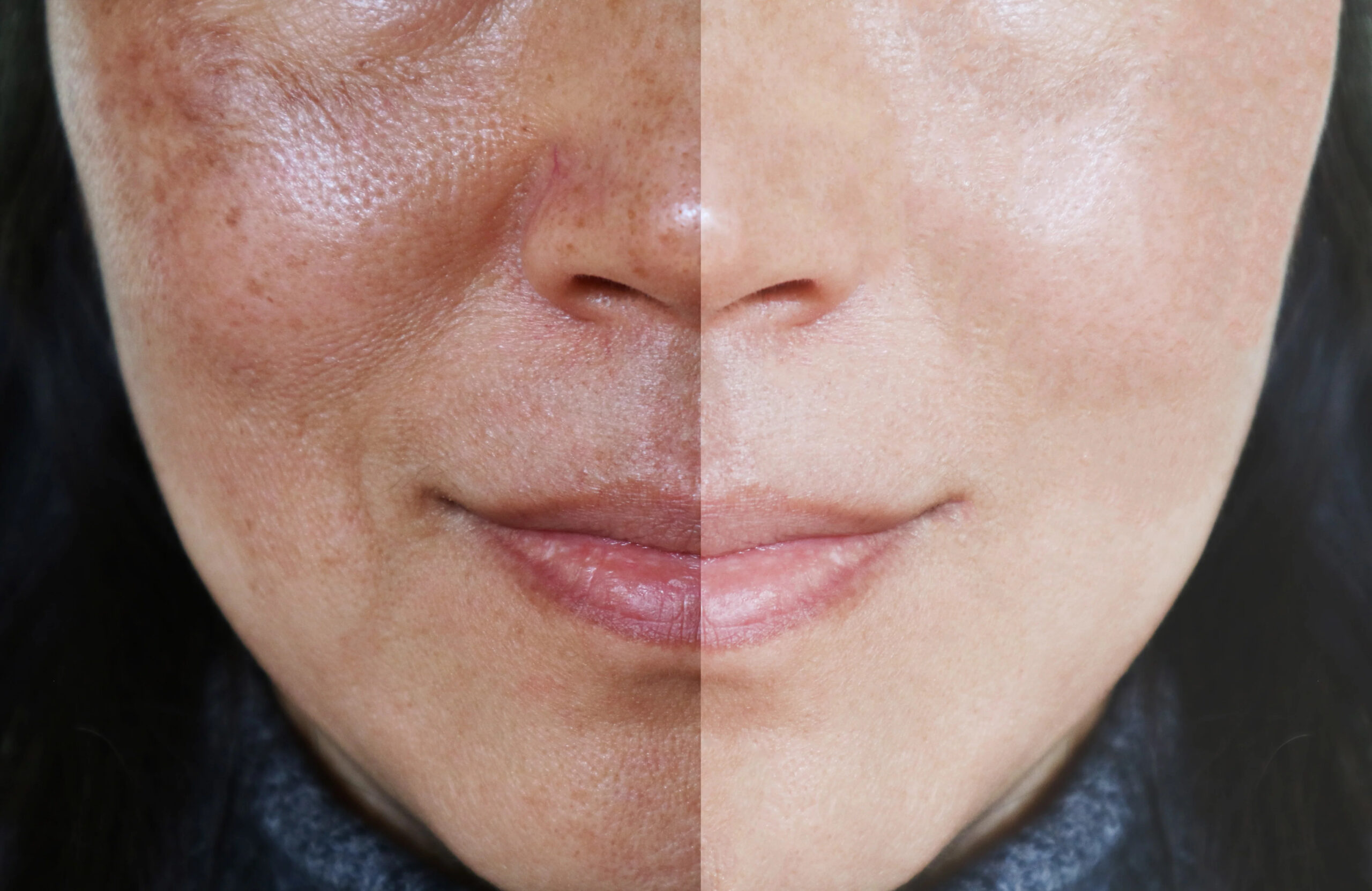 Dermatologists urge daily habits to keep skin healthy & glowing