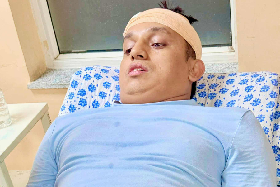 RSP leader Bhandari brutally attacked in Kathmandu