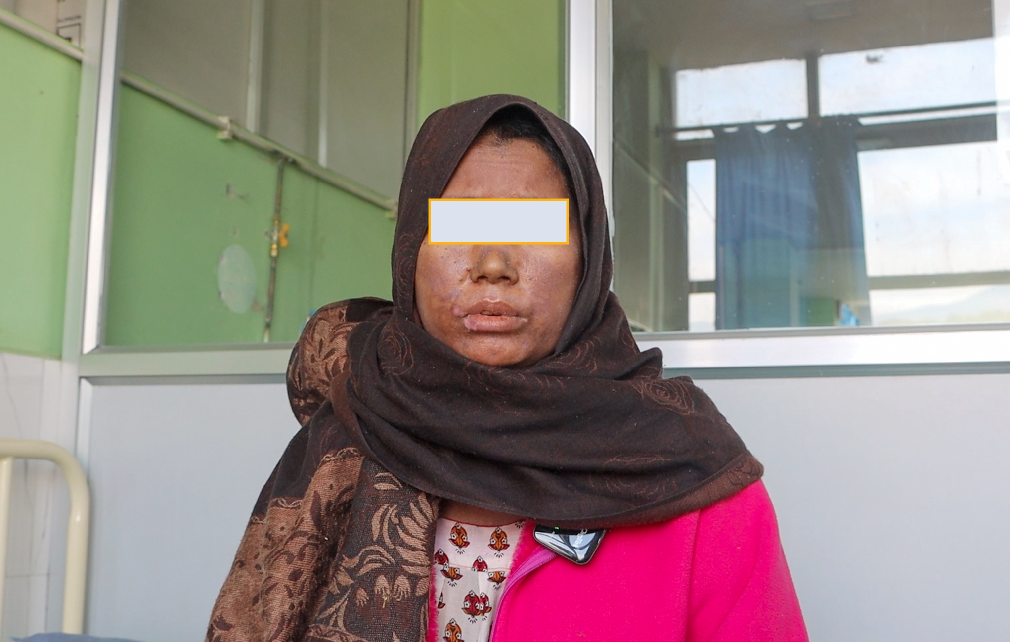 Rare skin disease successfully treated at NMC