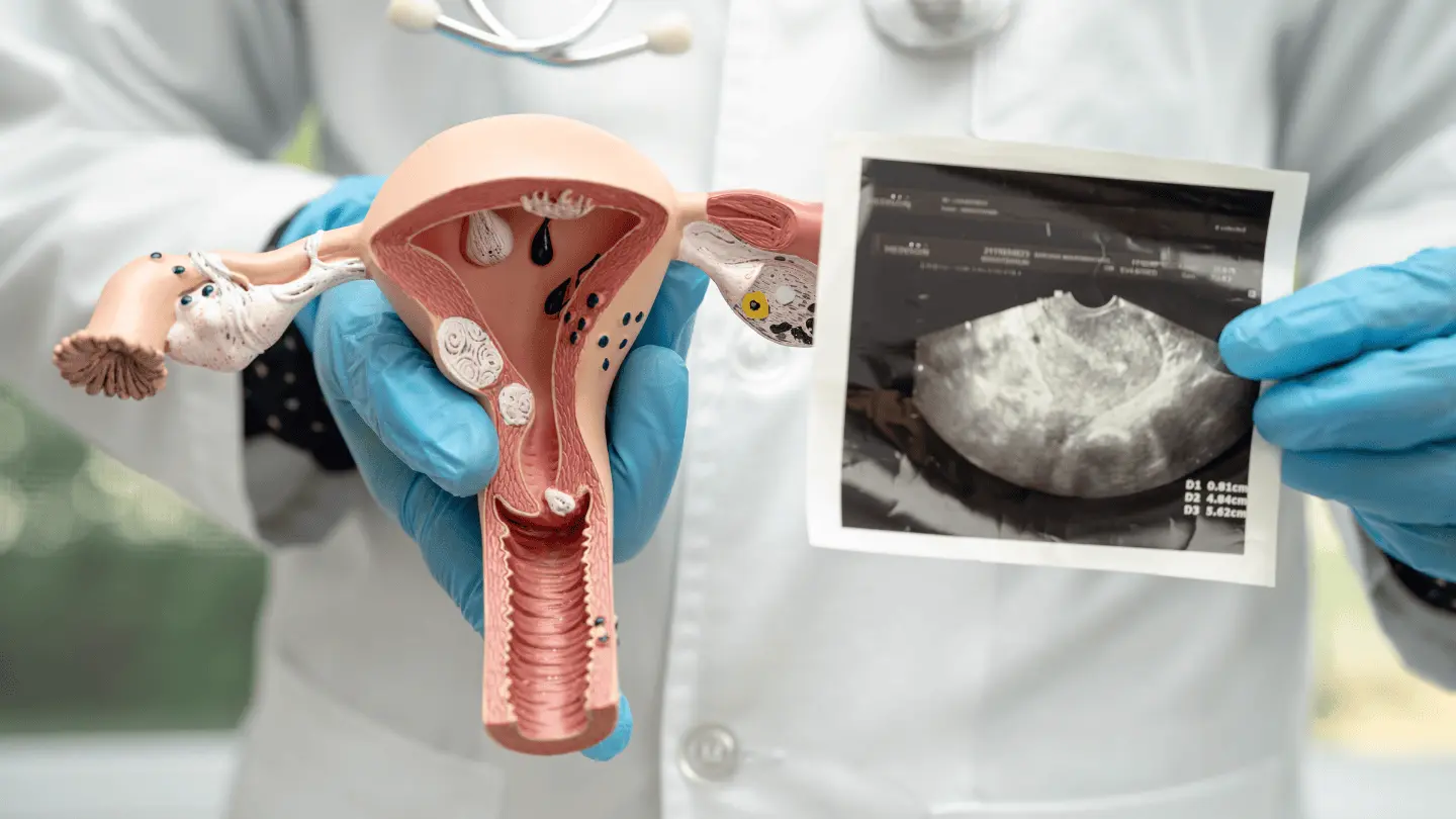 World Cervical Cancer Elimination Day: Screening & immunization imperative