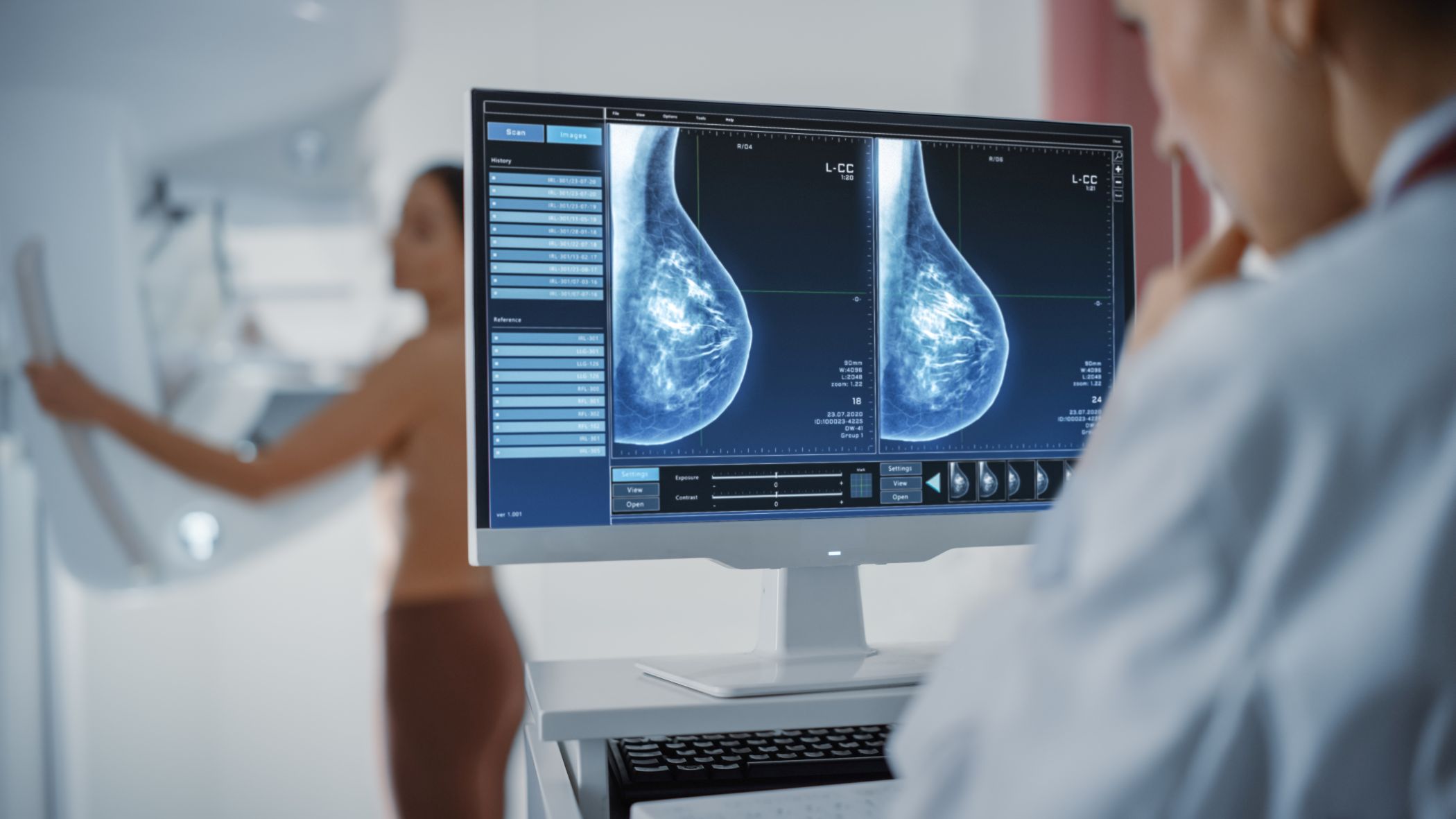 AI tool could predict breast cancer risk over next 4 years