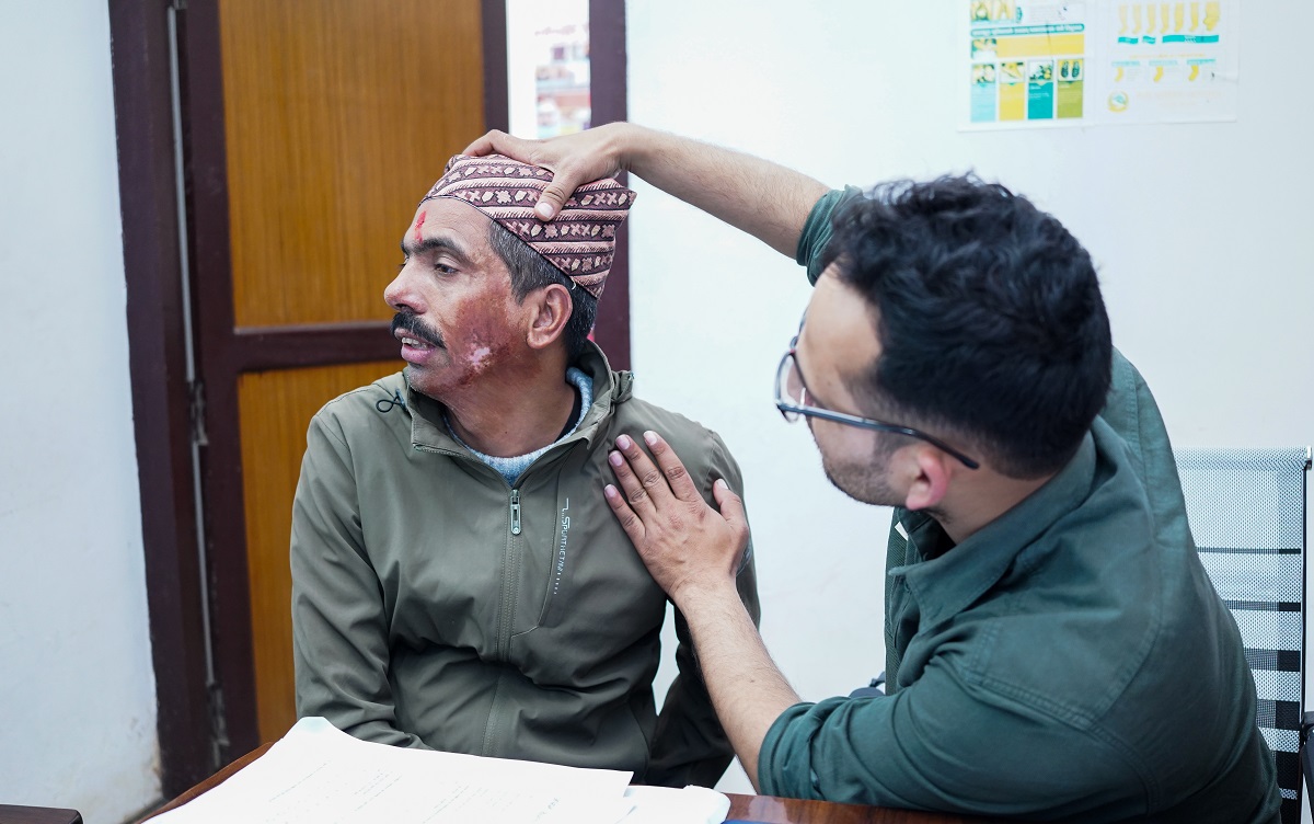 Nabil free burn treatment camp to be held in Surkhet from March 10-12