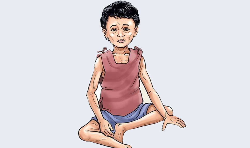 16% of children are malnourished in Madhesh